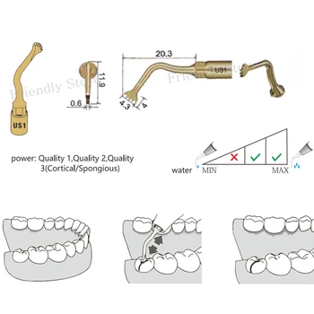 Pjovimo Patarimas 1PCS US1 Odontologas Odontologijos Įranga Ir Priemonės Dantų Pjezo Chirurgijos Patarimas MECTRON Ir GENYS Mašina